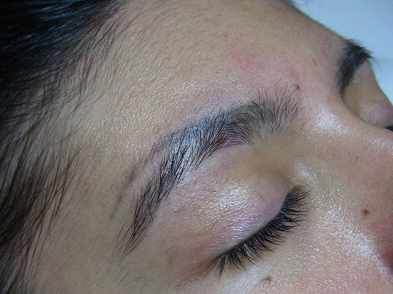 Laser Permanent Makeup Removal Saubhaya Makeup